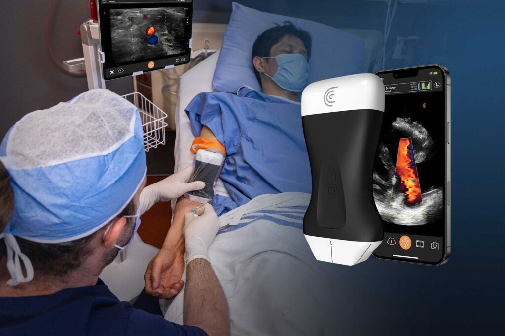 Clarius PAL Dual Array for Whole Body Ultrasound 1