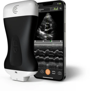 Product PA Phased Array Handheld Portable Wireless Ultrasound Scanner.png 1